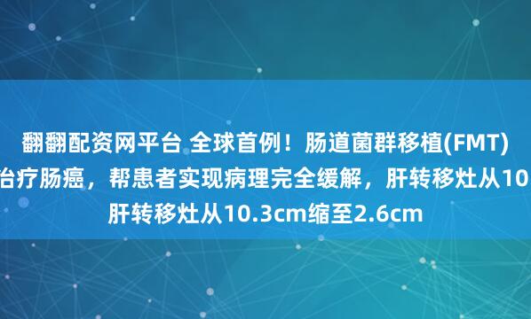 翻翻配资网平台 全球首例！肠道菌群移植(FMT)联合双靶向疗法治疗肠癌，帮患者实现病理完全缓解，肝转移灶从10.3cm缩至2.6cm